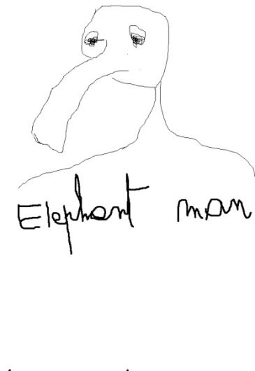 Elephant man